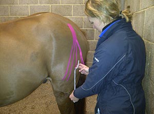 Taping to facilitate drainage of a haematoma to the biceps femoris